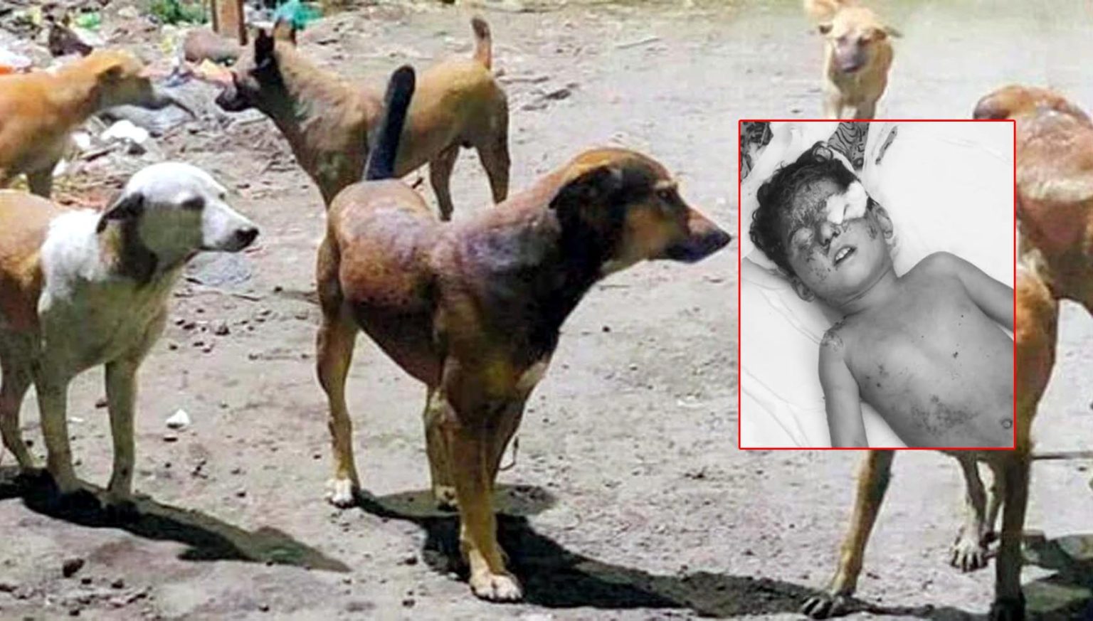 کوئٹہ , سریاب روڈ پر کتوں کے حملہ سے 8 سالہ بچہ جاں بحق، واقعے پر شہریوں کااحتجاج